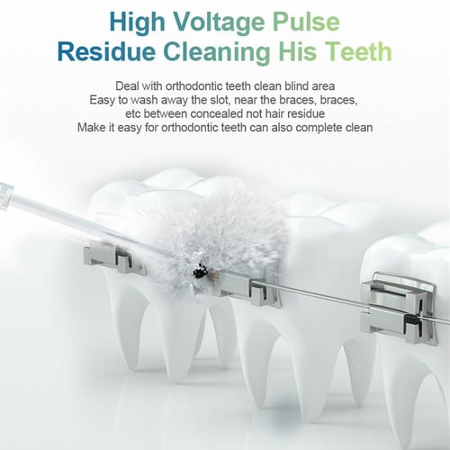 Portable Water Flosser | 360° Rotating Nozzle Oral Irrigator for Deep Cleaning